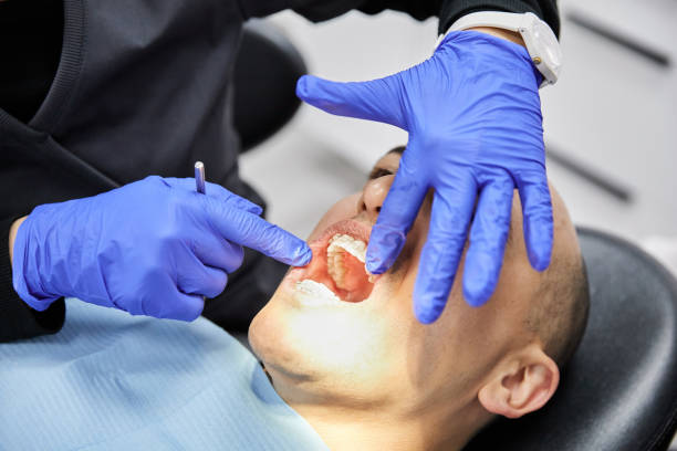 Best Emergency Wisdom Teeth Removal in Philippi, WV